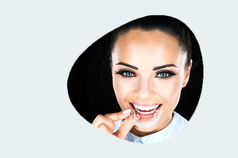 Invisalign Invisalign